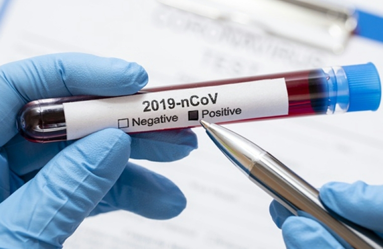 Imagen de Hablaron los dos hombres que dieron positivo al test de Coronavirus
