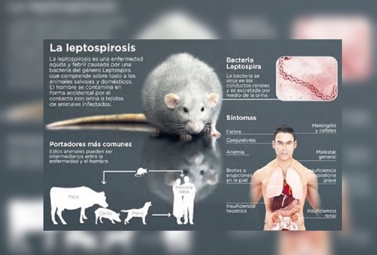 Imagen de Leptospirosis Qué es, cuáles son los síntomas, cómo se transmite, se trata y se previene esta enfermedad