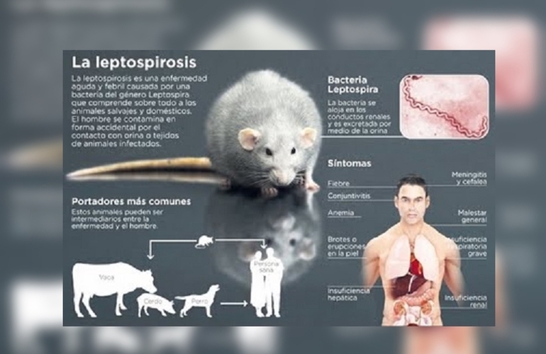 Imagen de Leptospirosis Qué es, cuáles son los síntomas, cómo se transmite, se trata y se previene esta enfermedad