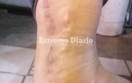 Imagen de Denunci&oacute; que un polic&iacute;a la agredi&oacute; durante un procedimiento