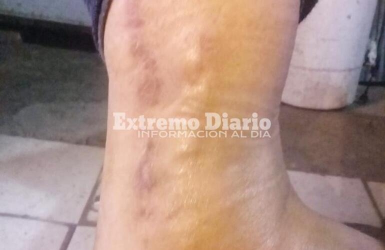 Imagen de Denunció que un policía la agredió durante un procedimiento