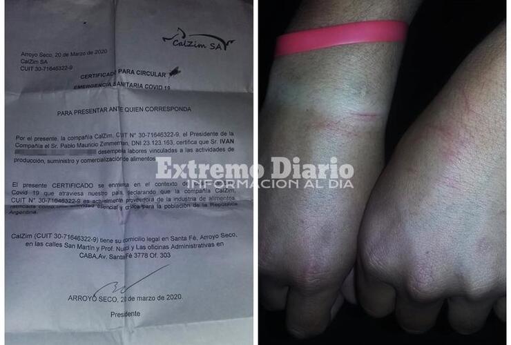 Foto 1. El certificado que el muchacho nunca pudo exhibir - Foto 2. Así le quedaron las muñecas tras la detención.