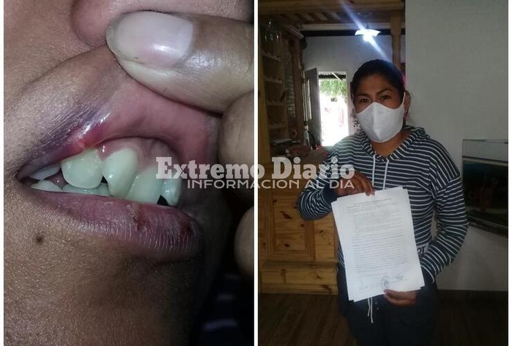 Imagen de Arroyo Seco: Denunció que la torturaron en la comisaría