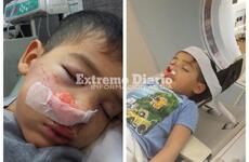 Imagen de Denunció negligencia de parte de una médica del Hospital: ´El nene estaba grave, no era para mandarme a dormir´