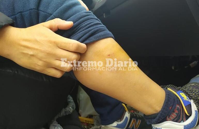 Imagen de La mordió un perro cuando iba en moto