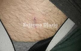 Imagen de Iban en moto y result&oacute; mordido por un perro