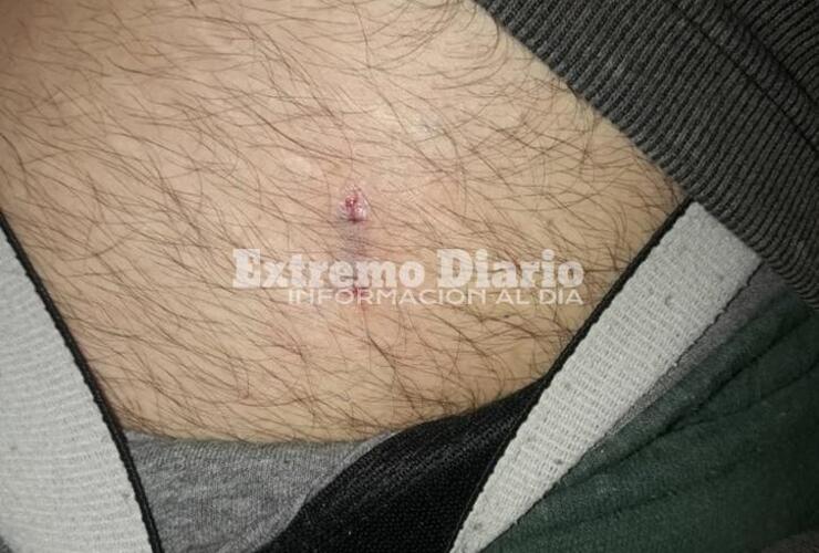 Imagen de Iban en moto y resultó mordido por un perro