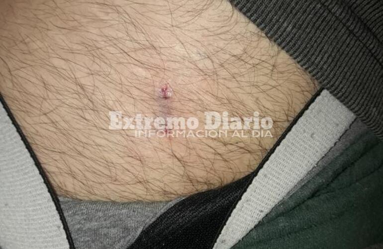 Imagen de Iban en moto y resultó mordido por un perro