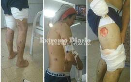 Imagen de Graves heridas reviste el joven lastimado con postas de goma por la polic&iacute;a