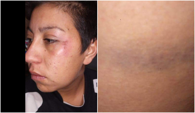 La mujer cansada del sufrimiento pidi&oacute; ayuda a la Justicia
