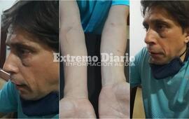 El violento hecho sucedi&oacute; en la v&iacute;a publicas mientras el funcionario supervisaba una obra.