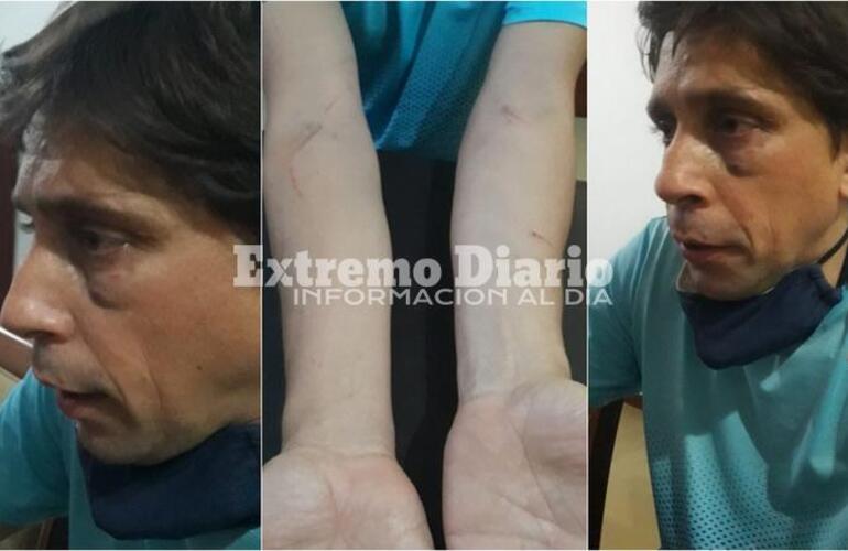 El violento hecho sucedió en la vía publicas mientras el funcionario supervisaba una obra.