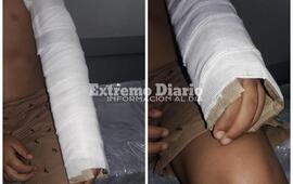 Imagen de &acute;Le dieron ibuprofeno y le pusieron un cart&oacute;n porque no ten&iacute;an f&eacute;rula&acute;