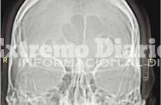 La radiograf&iacute;a que detect&oacute; su problema de salud