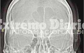 La radiograf&iacute;a que detect&oacute; su problema de salud