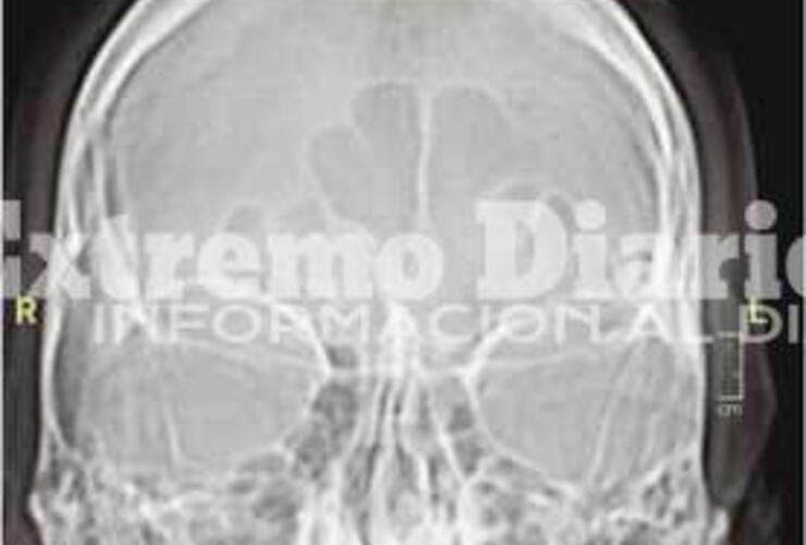 La radiografía que detectó su problema de salud