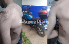 La familia del joven denunci&oacute; que un agente de polic&iacute;a provoc&oacute; su ca&iacute;da.