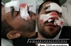 Imagen de Denunci&oacute; que patovicas le pegaron dentro del boliche