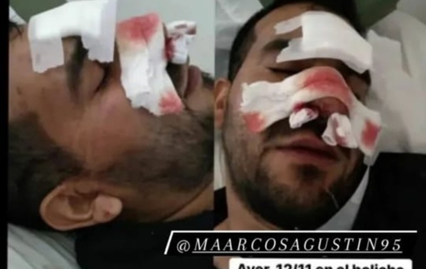 Imagen de Denunci&oacute; que patovicas le pegaron dentro del boliche