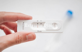 Imagen de En diez d&iacute;as llegar&iacute;an los Autotest de Covid-19 a las Farmacias