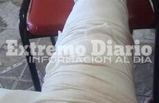 Imagen de Pollada solidaria: Sufrió un accidente y necesita 150 mil pesos para una operación