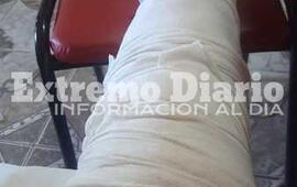 Imagen de Pollada solidaria: Sufri&oacute; un accidente y necesita 150 mil pesos para una operaci&oacute;n