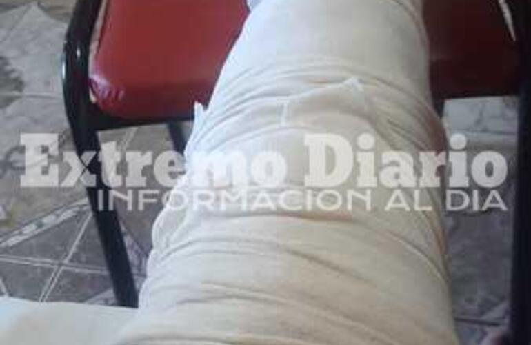 Imagen de Pollada solidaria: Sufrió un accidente y necesita 150 mil pesos para una operación