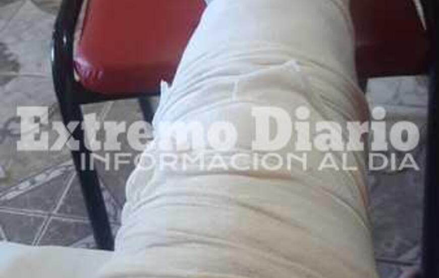 Imagen de Nueva pollada para que Tania Almada pueda pagar su operaci&oacute;n
