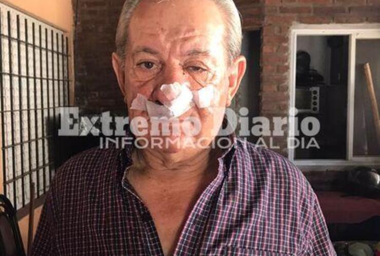 Nelson Papetti recibió un fuerte golpe en el tabique