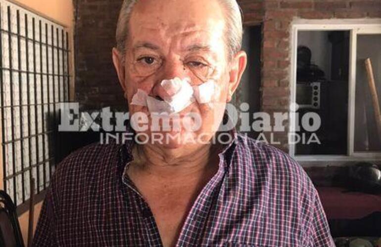 Nelson Papetti recibió un fuerte golpe en el tabique