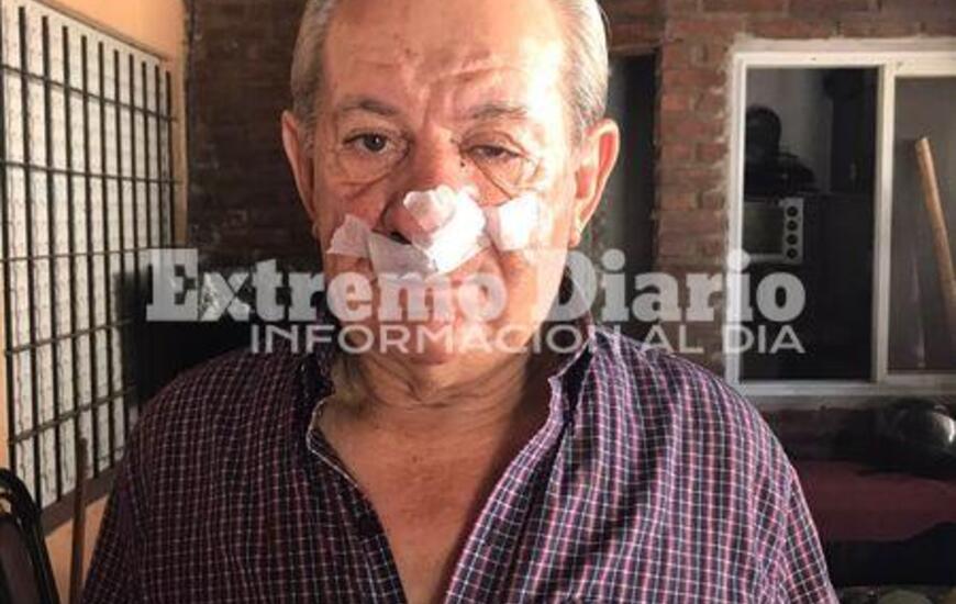 Nelson Papetti recibi&oacute; un fuerte golpe en el tabique