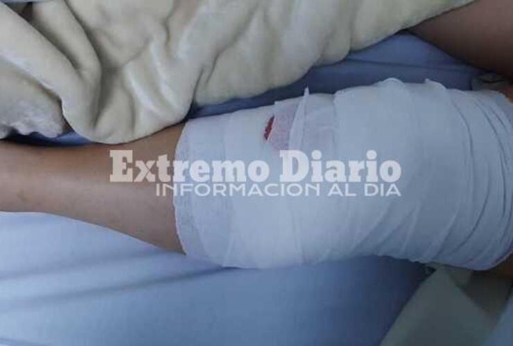 Imagen de Luego del accidente, Tania Almada logró reunir el dinero y se operó de la rodilla