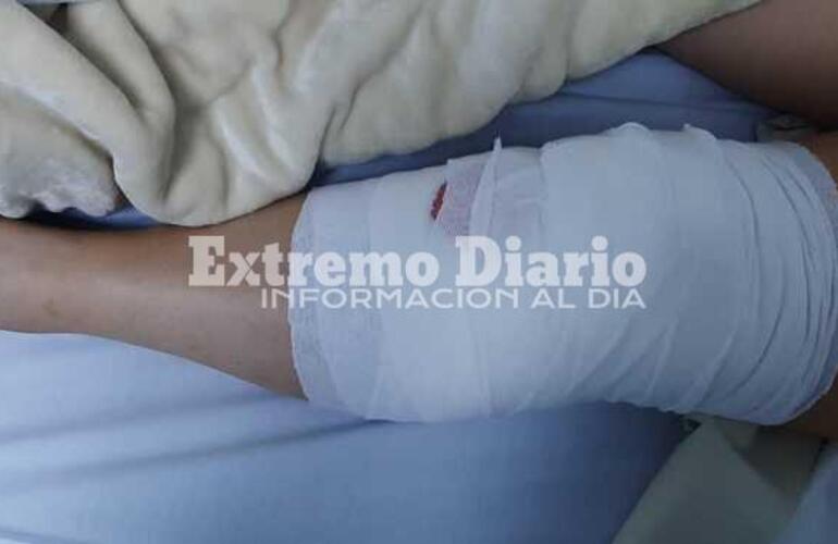 Imagen de Luego del accidente, Tania Almada logró reunir el dinero y se operó de la rodilla