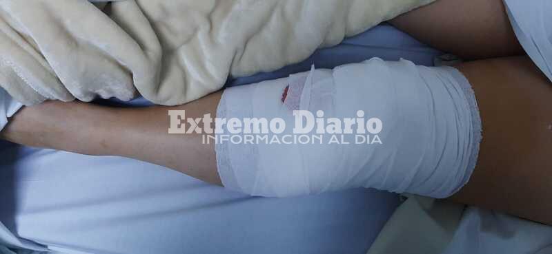 Imagen de Luego del accidente, Tania Almada logr&oacute; reunir el dinero y se oper&oacute; de la rodilla