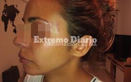 Imagen de Tiene 28 a&ntilde;os y denunci&oacute; que fue golpeada por su pareja