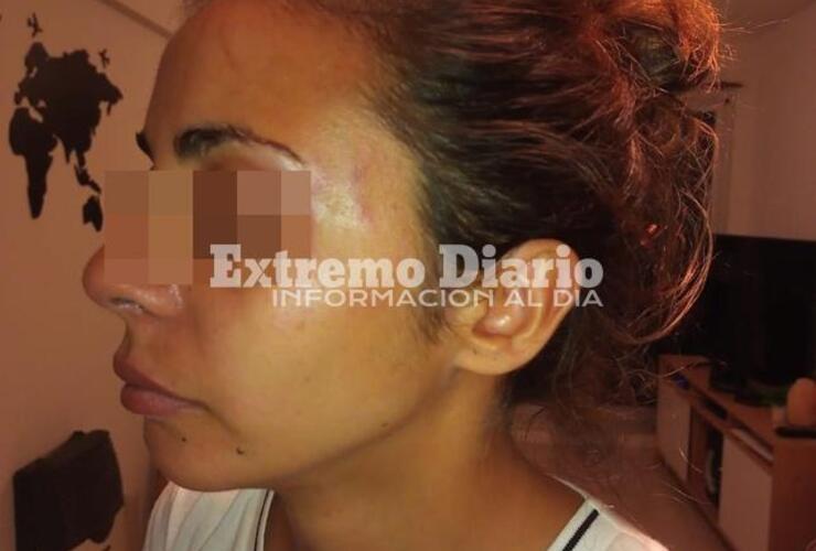 Imagen de Tiene 28 años y denunció que fue golpeada por su pareja