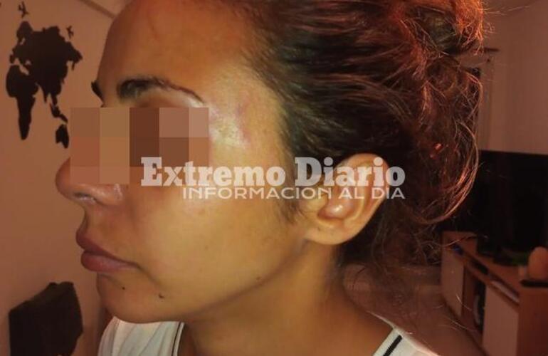 Imagen de Tiene 28 años y denunció que fue golpeada por su pareja