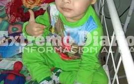 Imagen de Un ni&ntilde;o de tres a&ntilde;os necesita de un �electroestimulador facial� para poder operarse