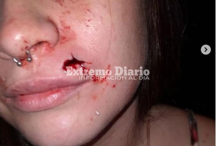 Una de las fotos publicada por la víctima en redes sociales.