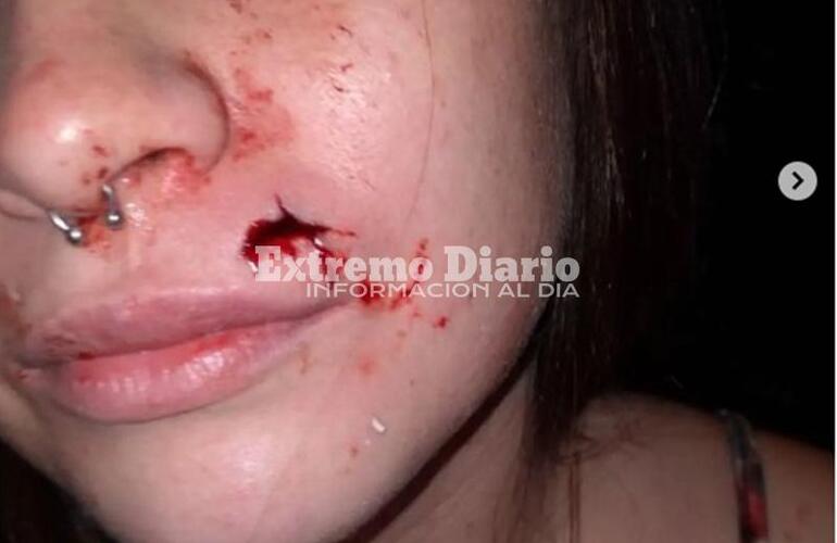 Una de las fotos publicada por la víctima en redes sociales.