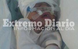 Imagen de Alejo, el bebe que necesita la ayuda de todos