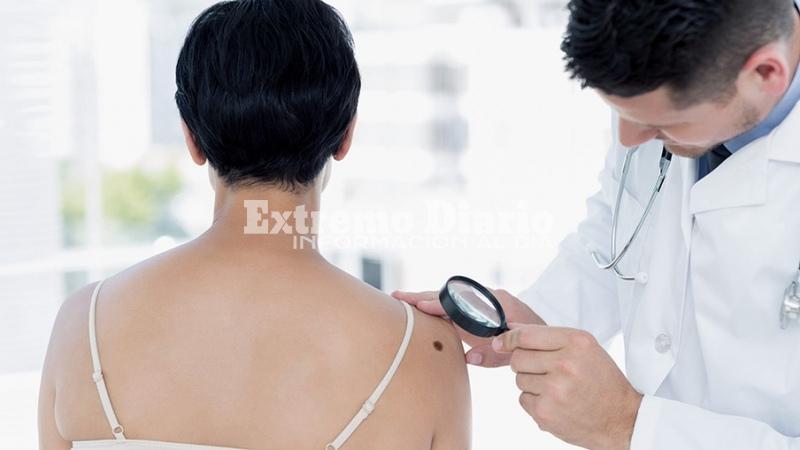 Imagen de D&iacute;a Mundial del Melanoma: Controlar lunares puede ser la principal medida de prevenci&oacute;n de este tipo de c&aacute;ncer de piel