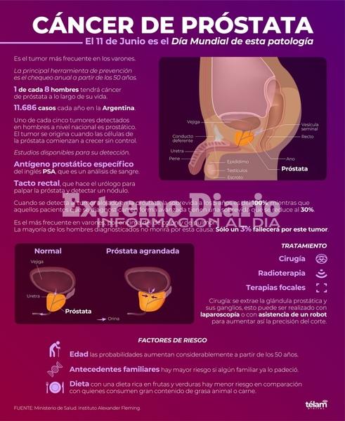 Imagen de Cosa de hombres: La importancia del chequeo anual a partir de los 50 a&ntilde;os para prevenir el C&aacute;ncer de Pr&oacute;stata