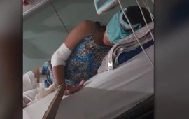 Imagen de Una nena fue atropellada por un motociclista que la dej&oacute; tirada y se fug&oacute;