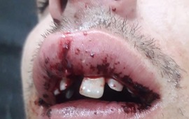 Imagen de Entre cuatro y hasta con una baldosa: un joven recibi&oacute; una feroz golpiza en San Jos&eacute; de la Esquina