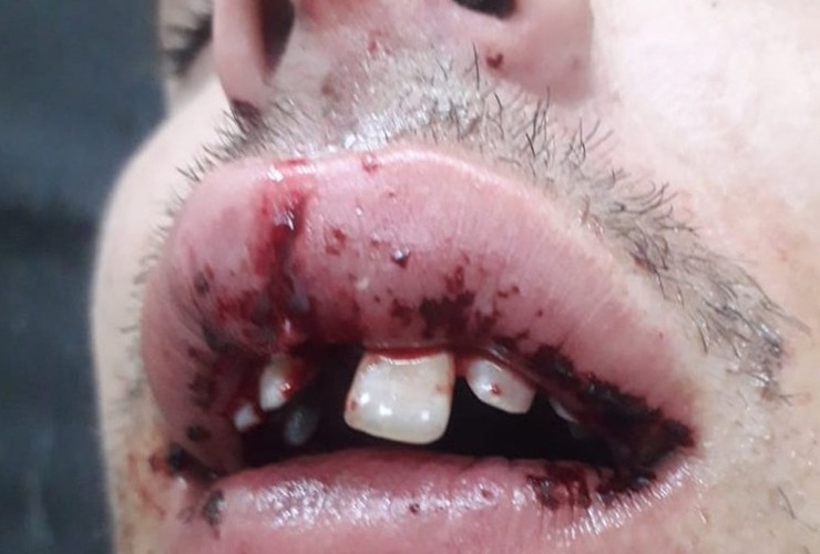 Imagen de Entre cuatro y hasta con una baldosa: un joven recibi&oacute; una feroz golpiza en San Jos&eacute; de la Esquina