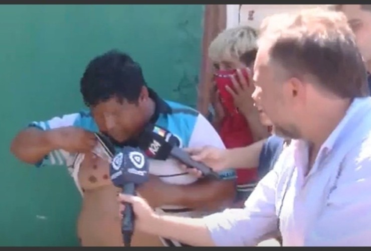 El pap&aacute; del nene asesinado muestra las heridas por bala de goma.