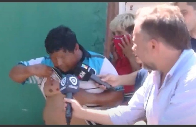 El pap&aacute; del nene asesinado muestra las heridas por bala de goma.