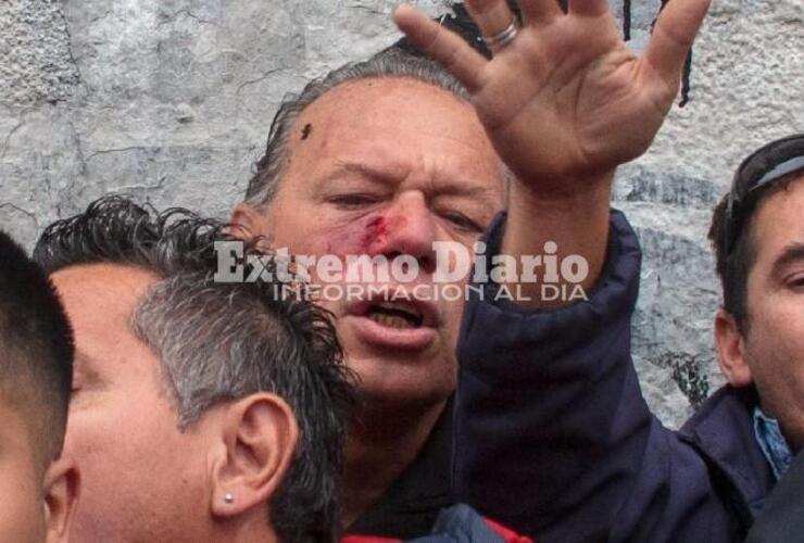 Imagen de Liberaron a los choferes que habían sido detenidos por la agresión a Sergio Berni