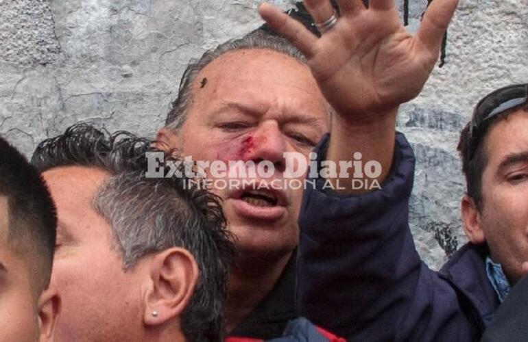 Imagen de Liberaron a los choferes que habían sido detenidos por la agresión a Sergio Berni